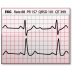 Documents-EKG icon